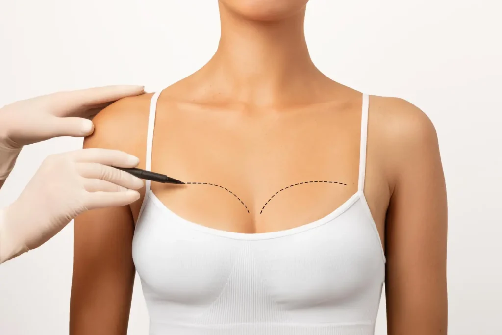 Mommy Makeover: qué procedimientos incluye, cómo se planifica y qué esperar antes de operarse explantacion de senos cirujano plastico